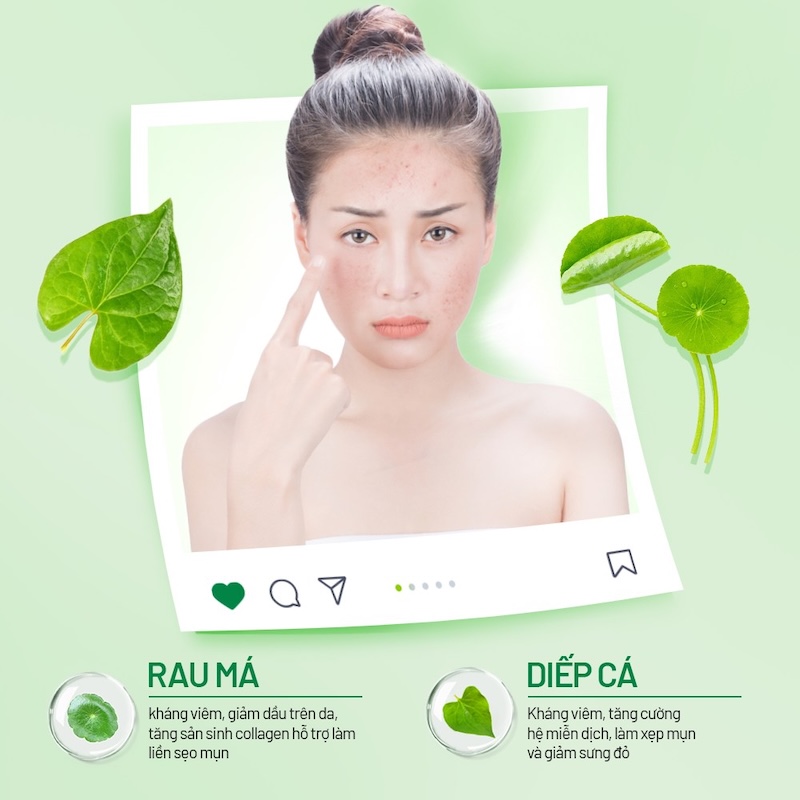 cham soc da mun tu rau ma diep ca