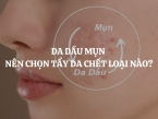 Da dầu mụn nên chọn tẩy da chết loại nào? Gợi ý giải pháp dịu nhẹ từ hạt gạo & mơ Herbario